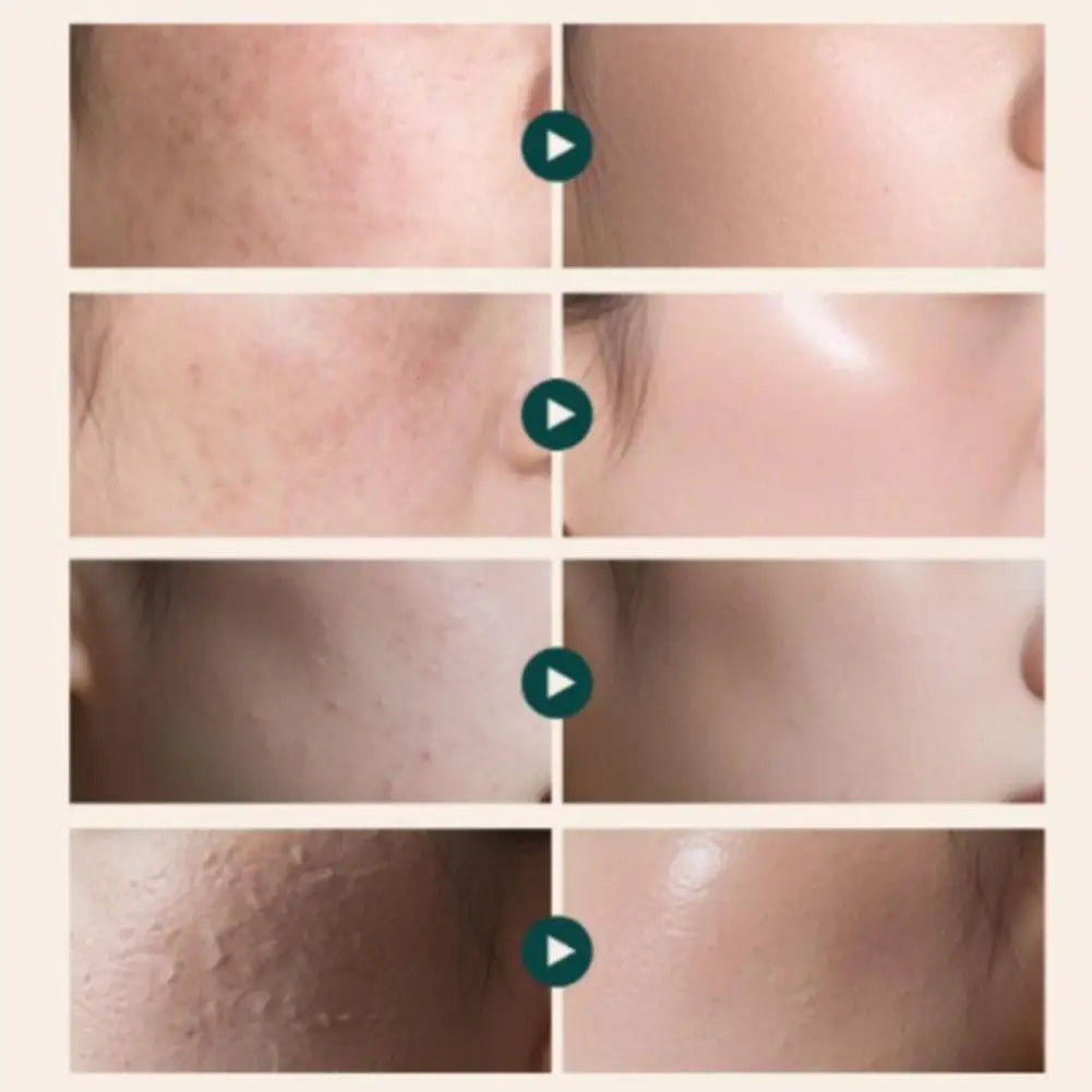Dr. REJUALL PDRN Repair Cream rich texture for sensitive skin